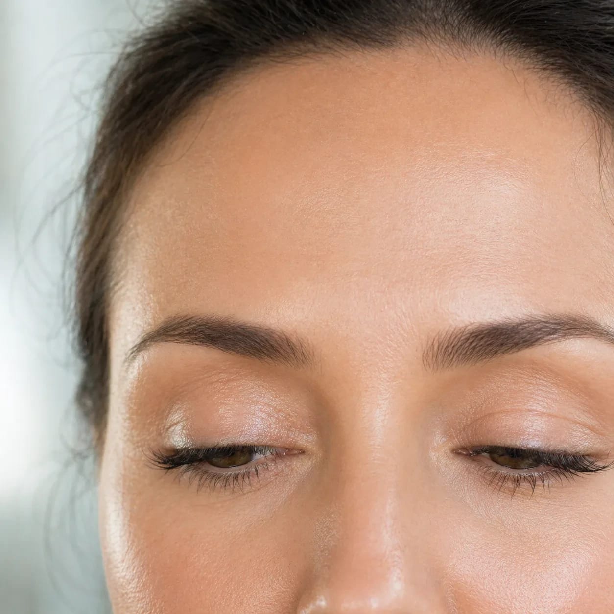 Botox, Cosmiatria Union, Joinville/SC
